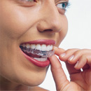 invisalign-set