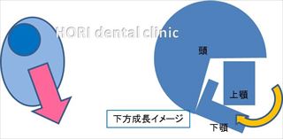 下方成長イメージ