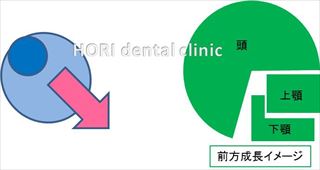 前方成長イメージ